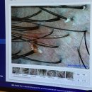 서울대입구역 1번출구 뒤 | 신림 지루성두피염 케어 후기 서울대입구역 두피각질 두피염증 관리 WT메소드 서울대점