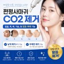 세연약국 - 북구 호계로 281 | 편평사마귀 레이저 제거 전/후 관리방법 및 주의사항