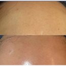 레티나메디칼 이미지