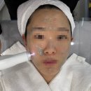 풋스올 충북청주점 | 청주피부관리 좁쌀 여드름압출 잘하는 올스킨 청주점 후기