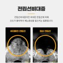 류비뇨기과의원 | 전립선비대증 수술 부작용이 적은 방법과 후기 정리