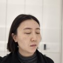 ㈜분당제일에너지 | 분당 피부과 아꼴스팟 토닝 후기 서현 피부과 잡티 미백 관리