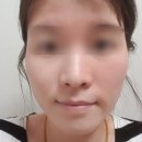 인셀덤서서울 이미지