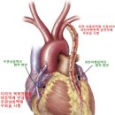 관상 동맥[冠狀動脈] 이란...... 이미지