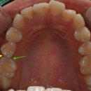 상주치과기공소 이미지