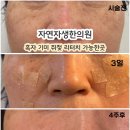 자연으로한의원 | 강남 흑자 색소질환 자연자생한의원 토닝후기