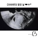 센트라스 산부인과의원 네이버블로그