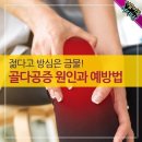 젊다고 방심은 금물! 골다공증 원인과 예방법 이미지