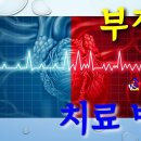 사암침, 사암침법 - 부정맥 치료 방법 - 비과학적 양의학 146 이미지