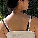 경도카클리닉 | [가양역피부과] 차앤유의원 승모근보톡스(원더톡스) 200유닛 내돈내산 후기