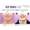 경주본치과의원 네이버블로그