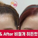 수헤어라인 이미지