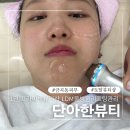 단아한 신발 | 수원 호매실 피부관리 추천 단아한뷰티 LDM물방울리프팅 관리로 속건조 잡은 후기