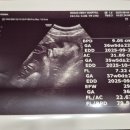 세실내과의원 | [서울임신일기] 36주 초음파 ❤️