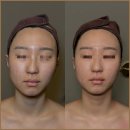 수정피부관리