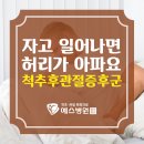 [건강TIP]자고 일어나면 허리가 아픈 척추후관절 증후군 이미지