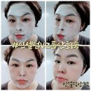 초이스 인셀덤 이미지