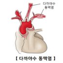 CRP(염증 수치)를 낮추는 현대 의학적 치료와 기능의학적 치료 그리고 항염식단 추천 이미지