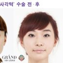 아로미라인 이미지