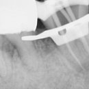 의정부본플란트치과의원 이미지