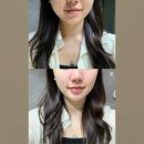 스노우가든 | 🌿 솝24 스노우가든 여드름 클렌징팩솝 사용 후기