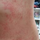 에이비한의원 이미지