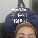 세븐일레븐(인천연수타운점) | 인천 두피관리 송도 닥터모락 캠퍼스타운역 두피관리 후기