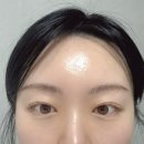 스킨더넥스트 | 엑소좀 앰플로 피부 밀도 관리해 본 후기 | 엑소머 더넥스트 셀부스터 프로그램