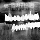 결치과의원 이미지