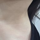 행복한마음한의원 | 대구편평사마귀성지 한의원에서 대구편평사마귀 대구쥐젖 내돈내산 무제한제거 받은 후기