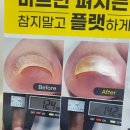 알미네일 이미지