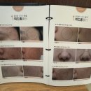 차한의원 | 코 모공 축소 시술 강북한의원 1회차 후기