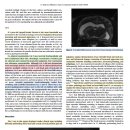 Chiari-like malformation이 있는 2마리의 페르시안 고양이에서 clinical presentation 이미지