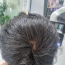 안양-안양-안양-521 | [안양브로우기프트] 남자 두피 관리 후기