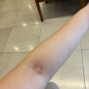 오월희망의원 | 보건소 난소검사 - 임신사전건강관리 산전검사 난소기능검사 AMH 초음파 수원 오월희망의원 후기