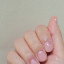팡이네일