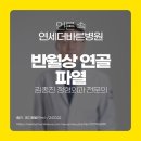 김종진 원장 [스포츠활동 중 발생하기 쉬운 반월상 연골 파열, 증상 및 주의점은?] 이미지