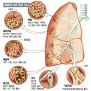 치아 단면도ㆍ폐 질환 종류 이미지