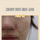 로담한의원 티스토리