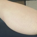 바디부스트 이미지