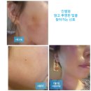 라온과학주식회사 | 인셀덤 리얼후기!!💖 놀라운 변화 모두 모두 이뻐져요