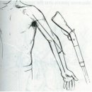 통굴한우영농조합법인 | 팔꿈치(주관절)주위의골절 #보령대천척추골반디스크교정 #보령대천재활 #보령대천PT #보령대천헬스장...