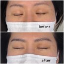 왕지5길 | 광주피부관리 다크써클 커버 후기