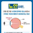 아이세이버 안경 소태점 이미지