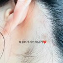 명현약국 | 동동이의 일상:) 지루성 두피염 n년차의 지루성 두피염에 좋다는 제품 사용 후기!! 4탄