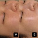 세븐일레븐 은평밝은점 | 💍 은평구 예비신부 피부관리, 연신내 기미 잡티제거로 시작✨