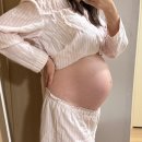 임신일기 / 임신후기 35주차 손발붓기 계속 심해짐, 발바닥 통증, 입술 양 옆 찢어짐, 편두통