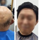 아이리스가발 파주점