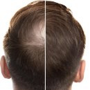 K2 Hair