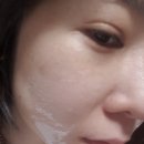 이오스타 강남지사점 볼륨 오투 에센스 후기